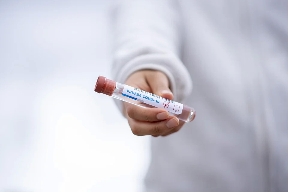 коронавирус test-tube-5065426_960_720.jpg