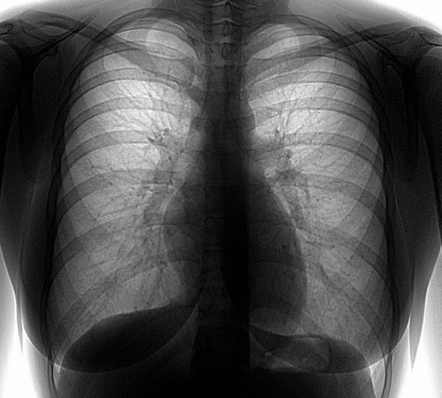 gde-sdelat-flyuorografiyu-v-ekaterinburge-528-large.jpg gde-sdelat-flyuorografiyu-v-ekaterinburge-528-large.jpg