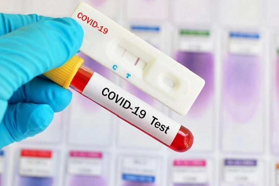 ratusan-ribu-alat-rapid-test-corona-masuk-indonesia-ini-cara-kerjanya-1584706581.jpg ratusan-ribu-alat-rapid-test-corona-masuk-indonesia-ini-cara-kerjanya-1584706581.jpg