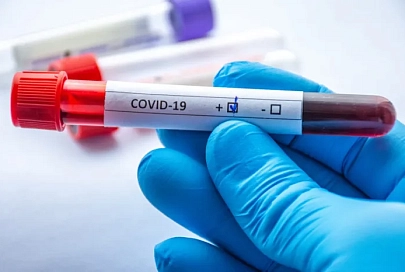 За сутки в Беларуси зарегистрированы 605 пациентов с COVID-19, выписаны 262