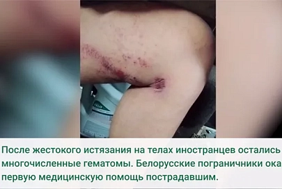 Еще двое беженцев подверглись жестокости латвийских силовиков