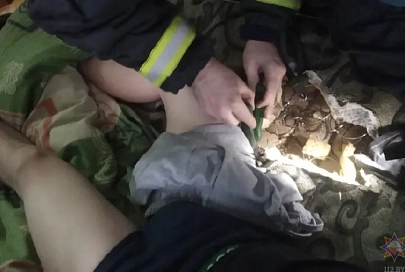 В Мозыре спасатели помогли молодому человеку, которому пружина матраса вонзилась в ногу