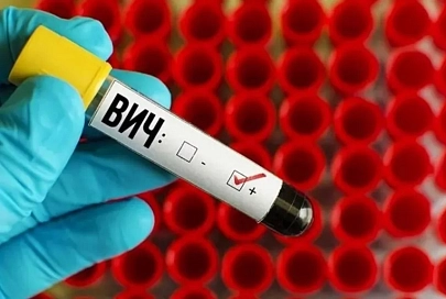 Социальный ярлык человека, живущего с ВИЧ, стал преградой в борьбе с вирусом
