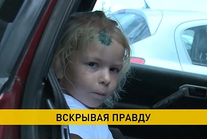 Фотографии девочки, которая якобы пострадала в ДТП с автомобилем ОМОНа, облетели сеть. Как все было на самом деле?