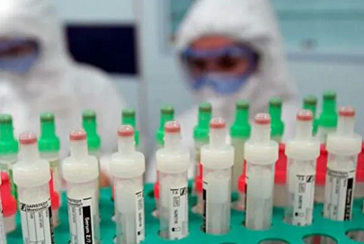 В Беларуси зарегистрированы 72 тыс. 485 человек с положительным тестом на COVID-19