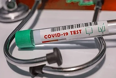 Минздрав: вторую волну COVID-19 в Беларуси прогнозируют менее интенсивной