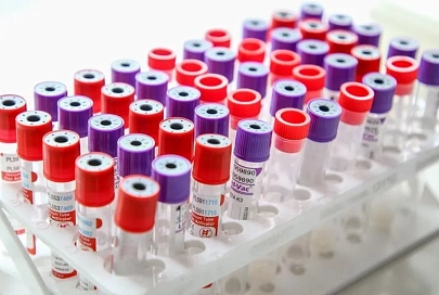В Беларуси зарегистрированы 86 тыс. 392 человека с положительным тестом на COVID-19