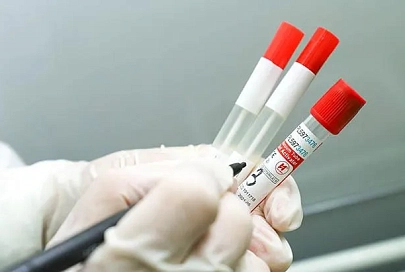 В Беларуси выздоровели и выписаны 87 400 пациентов с COVID-19