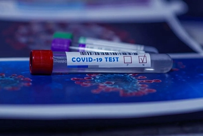 В Беларуси зарегистрированы 106 тыс. 279 человек с положительным тестом на COVID-19