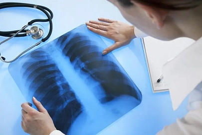 Как укрепить легкие после COVID-19? Рассказывает врач