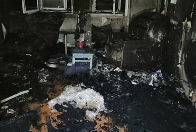 В Кормянском районе мужчина получил травмы на пожаре