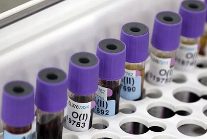 За сутки в Беларуси зарегистрированы 847 пациентов с COVID-19, выписаны 754