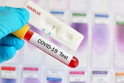 За сутки в Беларуси зарегистрированы 1170 пациентов с COVID-19, выписаны 1307